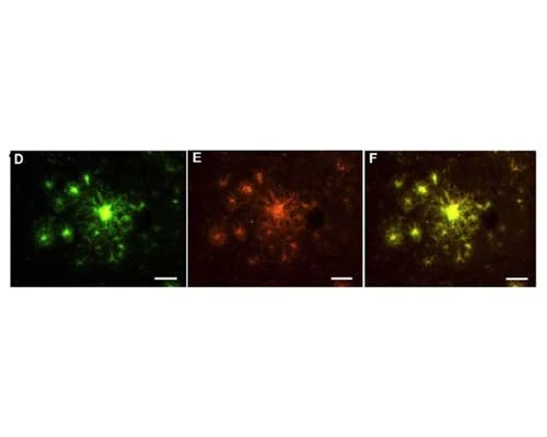 HQ-O RTD Amyloid Plaque Stain Reagent - Image 3