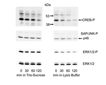 ELISA Kits & Reagents